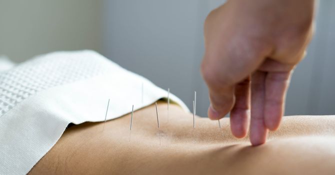Mei Zen Cosmetic Acupuncture