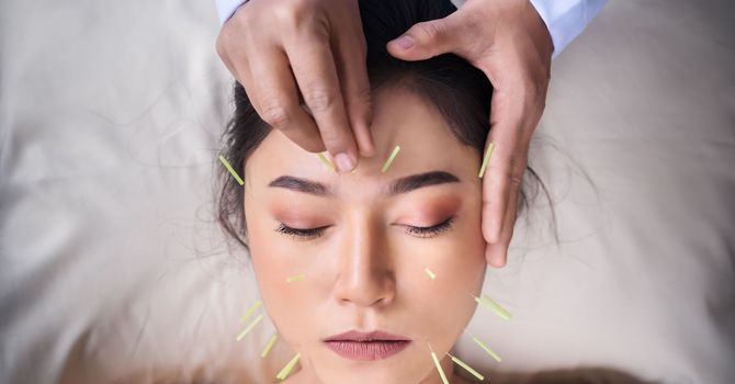Mei Zen Cosmetic Acupuncture